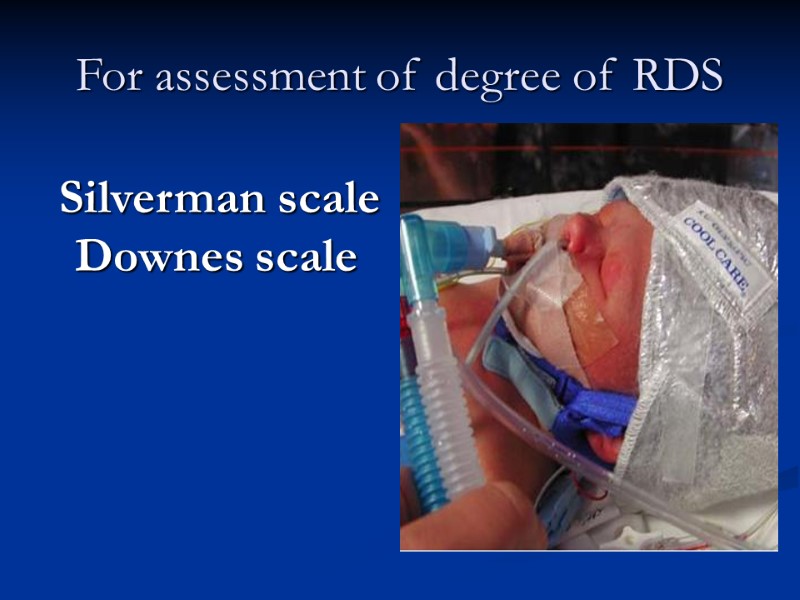 For assessment of degree of RDS   Silverman scale Downes scale